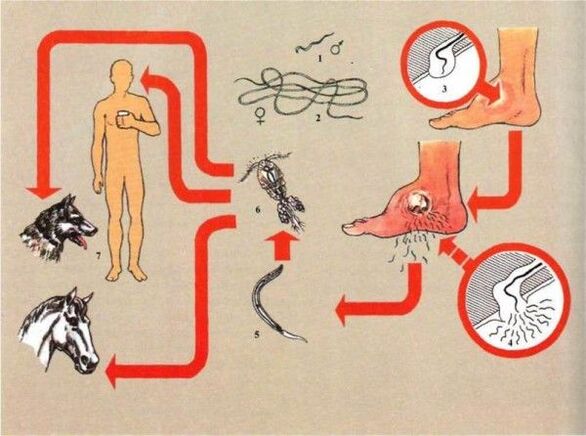 Drakunkulozes attīstība